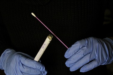 All it takes is a quick swab for females to screen for STIs such as chlamydia and gonorrhoea. Photo: Deborah Oomen